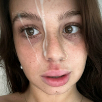 Fitalexis Nue