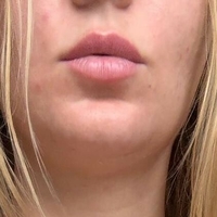 Laurie_Berlin Nue
